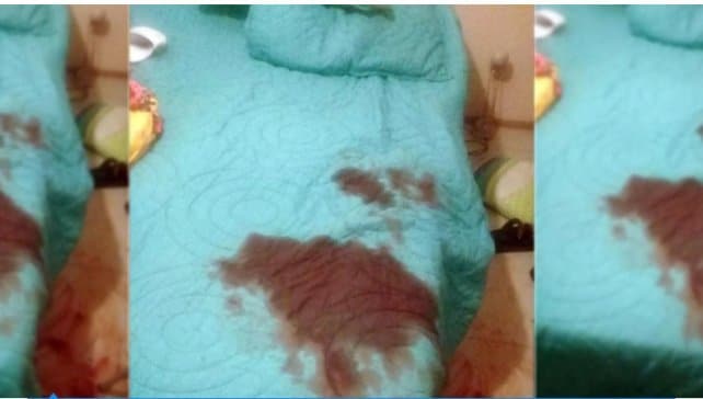 Argentinian girlfriend cuts off boyfriend’s penis.