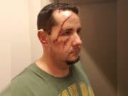 41 stitches: Naples man mauled by bear while taking dog for walk (but survives). Andrew Meunier
