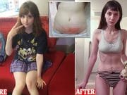 119lbs: Venus Palermo YouTube star weight loss surgery nearly kills her Venus Palermo aka Venus Angelic.