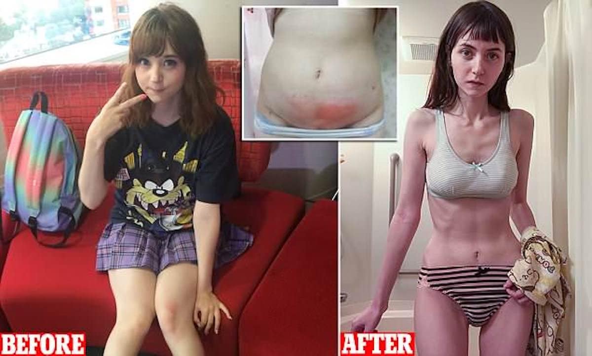 How Venus Palermo aka YouTube star, Venus Angelic nearly died after already...