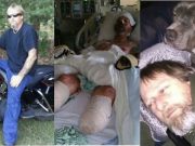 Wisconsin man has 4 limbs amputated after pet dog licks him. Greg Manteufel