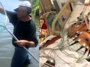 Crab fishing NJ dad contracts necrotizing fasciitis to lose all four limbs as condition deteriorates Angel Perez