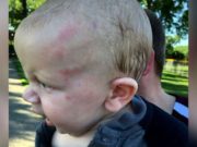 ‘Hand shaped bruise’ Kansas daycare shuts down after six month old baby allegedly abused Glen Braun Kansas 6 month old baby boy