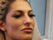 Lauren L. Klavano Botox Bandit