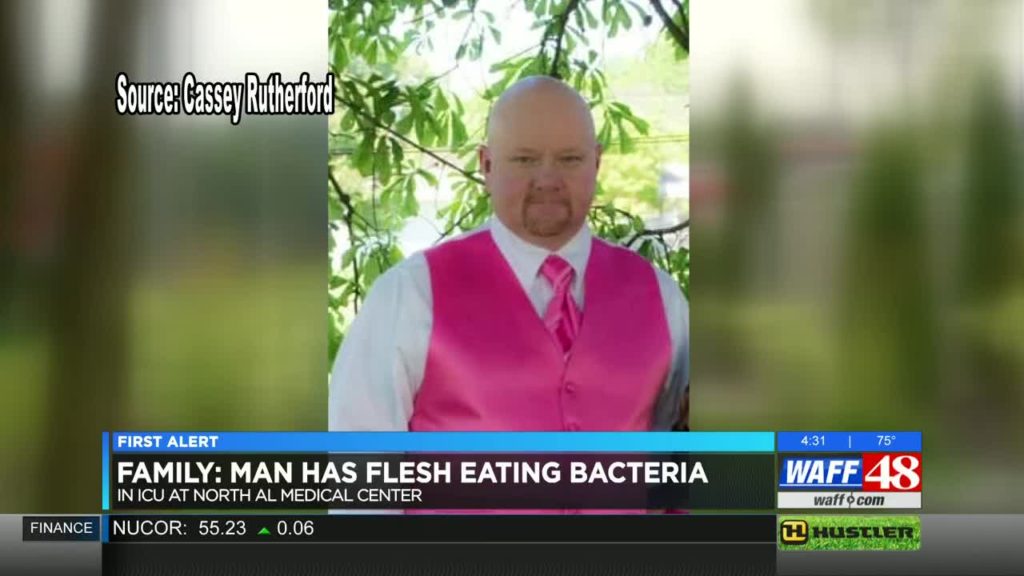 Ricky Rutherford Alabama man contracts mystery flesh eating bacteria