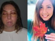 Canada flight attendant beaten in Mexico hotel room attack risks losing eyesight Lexie York flight attendant