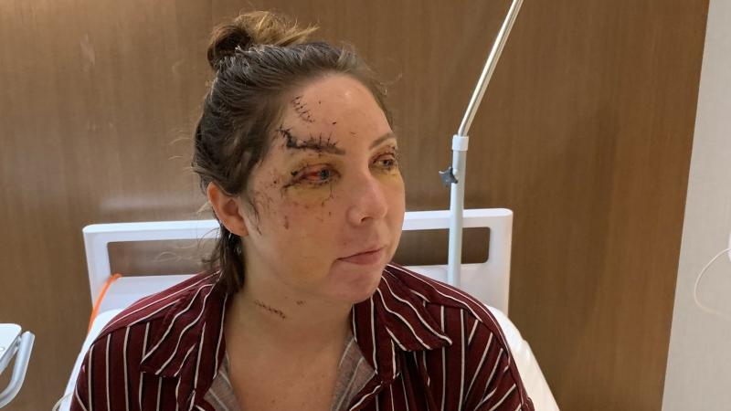 Canadian flight attendant attacked at Mexico resort