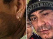 Mahud Villalaz Milwaukee acid attack