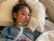 Emmalyn Nguyen plastic surgery botched
