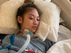 Emmalyn Nguyen plastic surgery botched