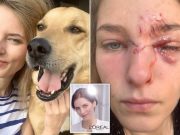 Polish L’Oreal model has face destroyed after adopted rescue dog attacks her Aleksandra Prykowska
