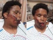‘We want answers’ Bronx teen, 16, left brutalized by NYPD cops during protests Jahmel Leach