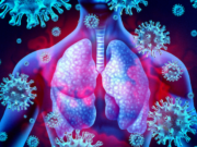 Synairgen release COVID drug trial results: but what next? Synairgen SNG001 Coronavirus trial