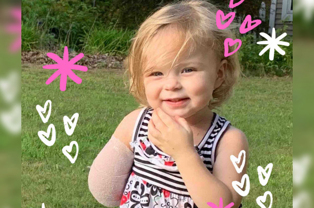 Sophia Scraver Michigan 2 year old girl arm ripped off wolf dog