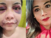 Texas Senate GOP contender beaten