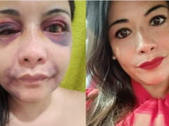 Texas Senate GOP contender beaten