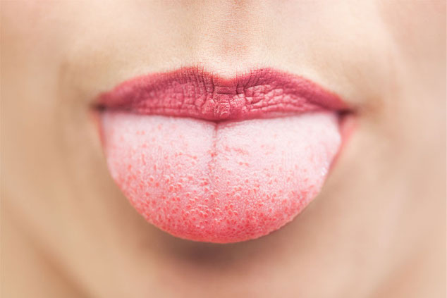 Vapers Tongue
