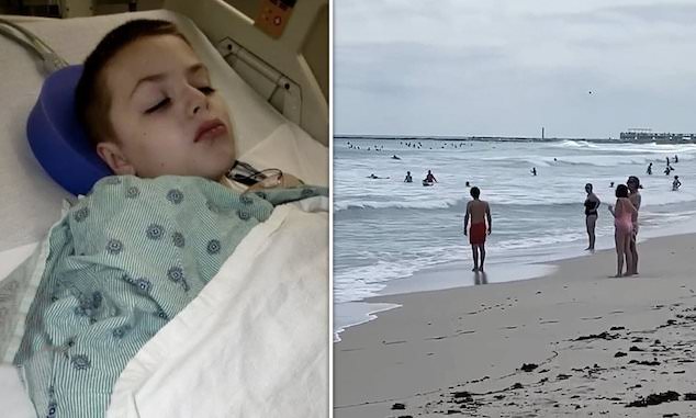 Jay Weiskopf Minnesota boy, 9, shark attack Miami Beach