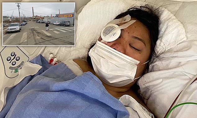 California teen girl, 19, shot through the eye in San Francisco