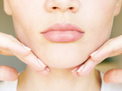 Getting Rid of Double Chin