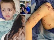 Jay Weiskopf Minnesota 9 year old boy survives Miami Beach shark attack
