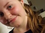 Las Vegas teen has 3 brain surgeries after J&J vaccine to clear blood clots