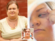 Katie Beith eye glued shut