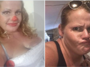 Unlicensed Nevada dental worker pulls 13 teeth from patient, steals $22K Laurel Eich Reno Nevada