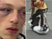 Caliber Visuals photographer brutally attacked & robbed in Seattle