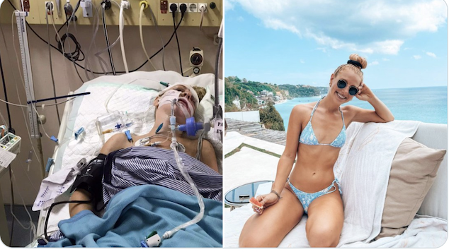 Kaitlyn McCaffery California travel blogger in coma after Bali scooter crash