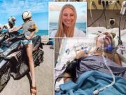 California travel blogger in coma after Bali scooter crash