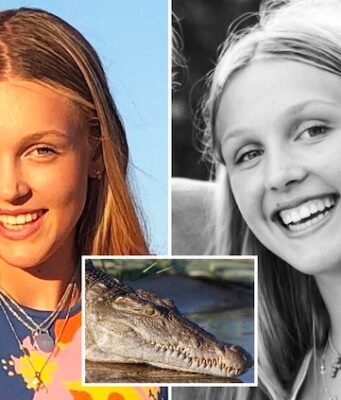 Amelie Osborn-Smith British teenager survives Zambia crocodile attack