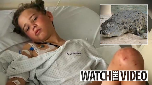 Amelie Osborn-Smith British teenager survives Zambia crocodile attack