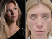 Yulia Tarasevich Russian beauty queen plastic surgery