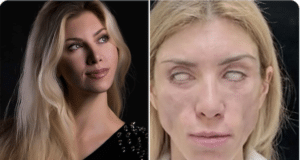 Yulia Tarasevich Russian beauty queen plastic surgery