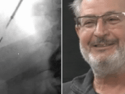 Tom Jozsi Illinois man accidentally inhales dental drill