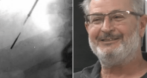 Tom Jozsi Illinois man accidentally inhales dental drill