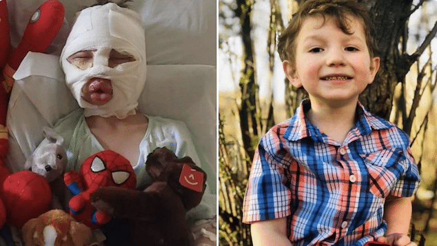 Dominick Krankall 6 year old Connecticut boy wasn’t bully target