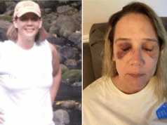 Michelle Audo Missouri mom beaten by teen girls