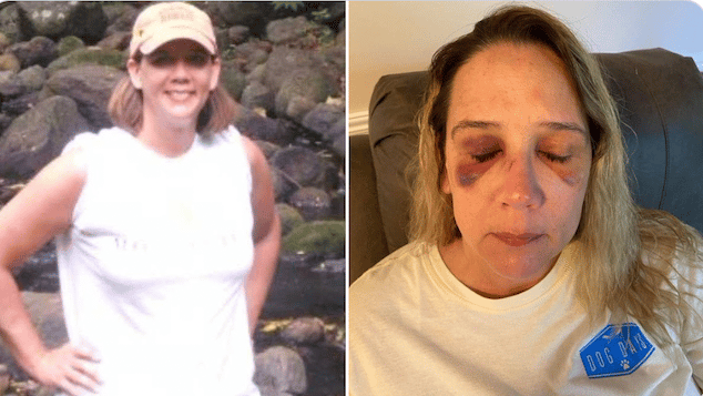 Michelle Audo Missouri mom beaten by teen girls
