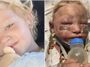 Felicity Peden 2 year old girl mutilated mauled by puppies.
