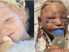 Felicity Peden 2 year old girl mutilated mauled by puppies.