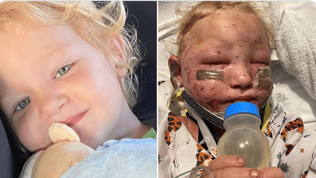 Felicity Peden 2 year old girl mutilated mauled by puppies.