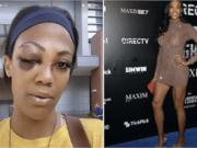 Kim Glass ex Olympic volleyball player beaten by homeless man with pipe