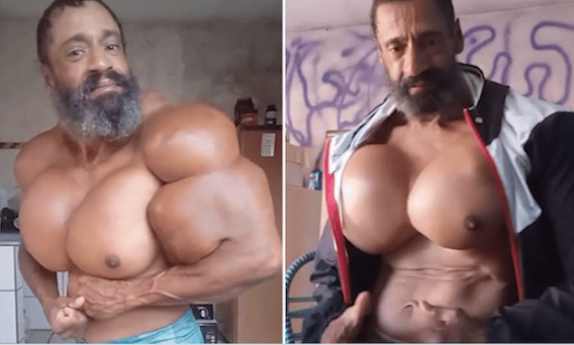 Valdir Segato aka Brazilian bodybuilder dead injecting self with oil