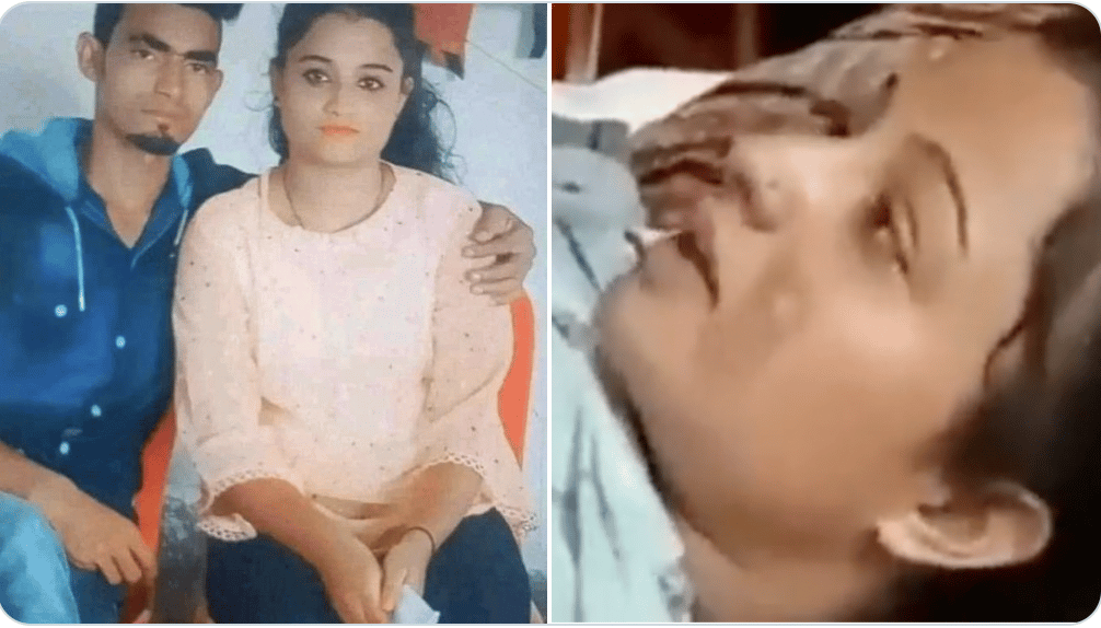 Ankita Singh Indian teen girl set on fire rejecting marriage proposal