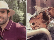 Carlos David Castro Rojas Texas patient wins $21M in botched anesthesia procedure