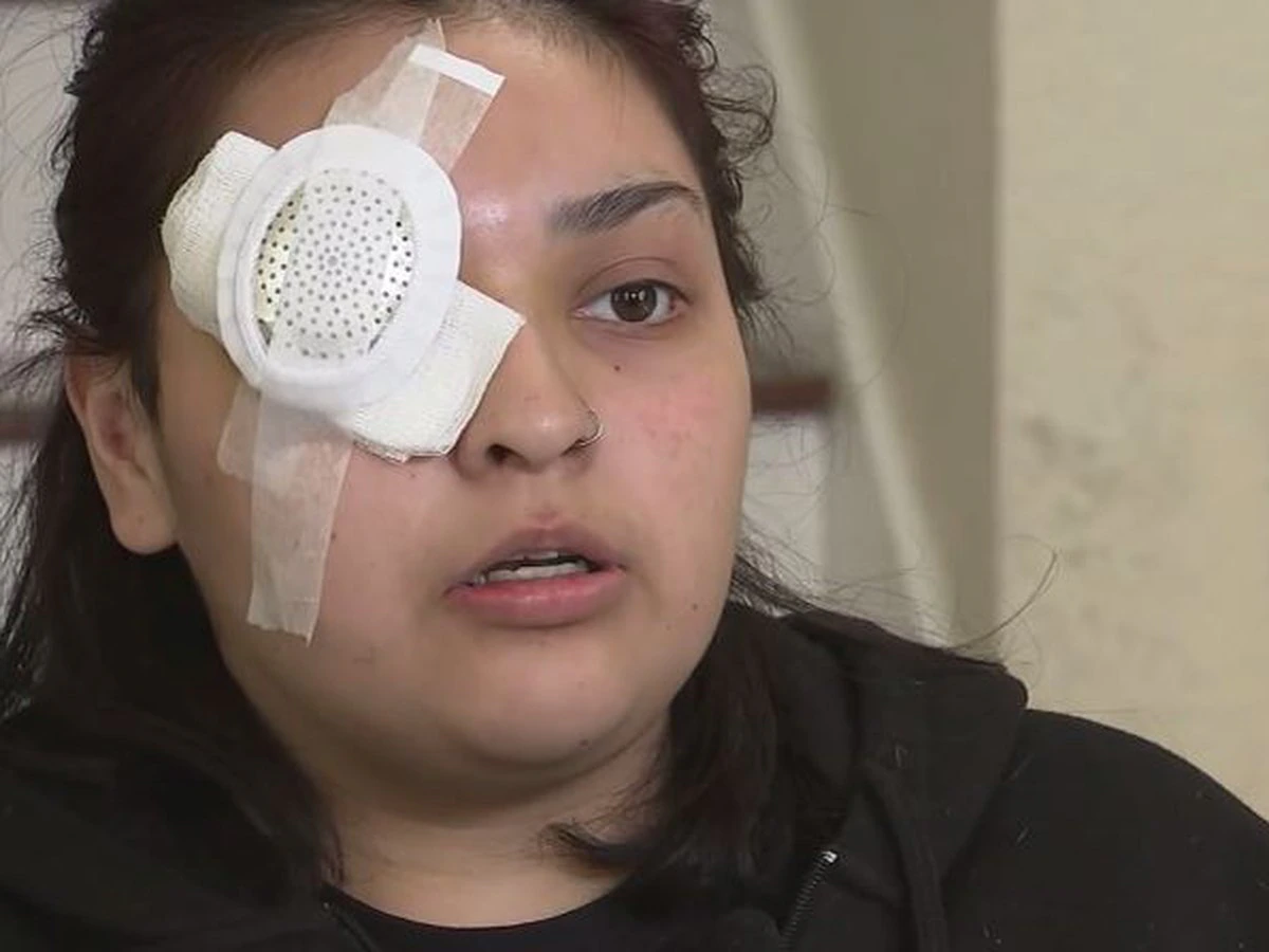 Bianca Palomera fast food worker loses eye