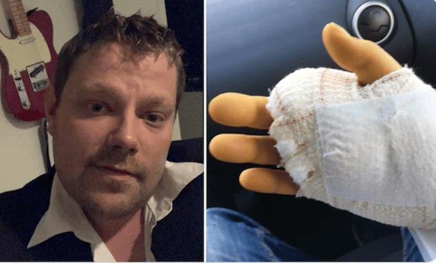 Henrik Kriegbaum Plettner Danish man dies 4 yrs after pet cat bite