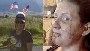 Jen Royce otter attack: Montana woman tubing outing nearly lethal